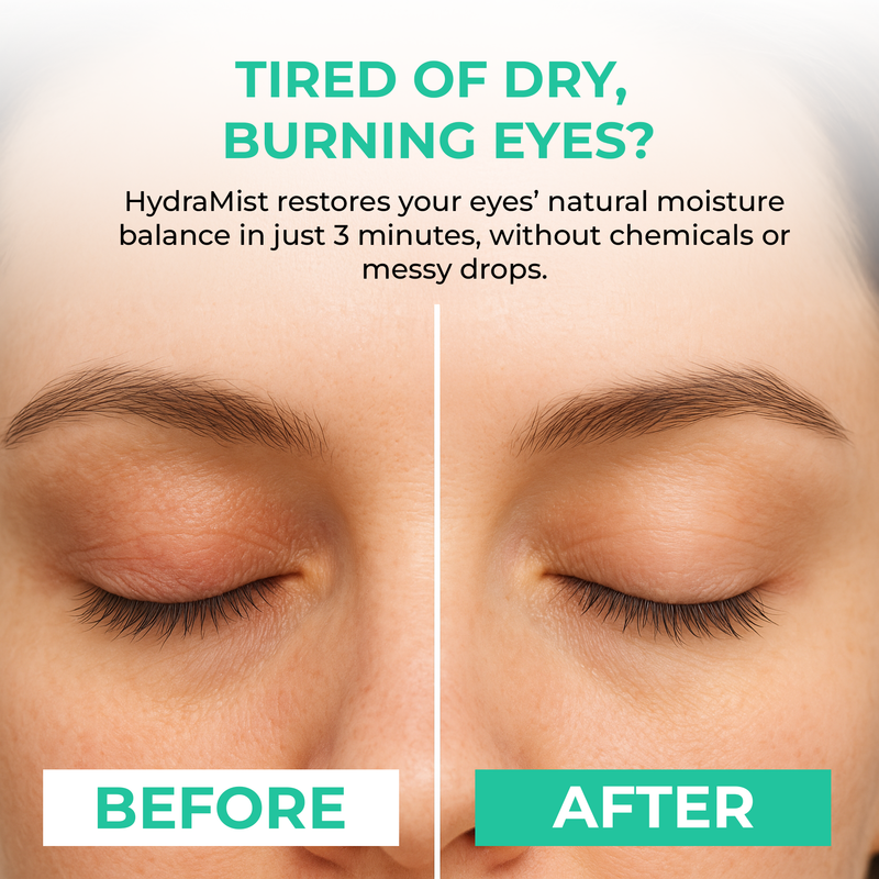 HydraMist Eye Steamer