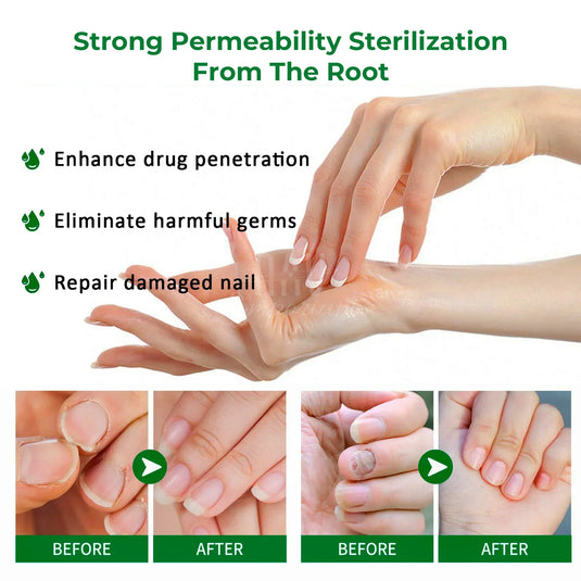 Fast-acting nail repair serum