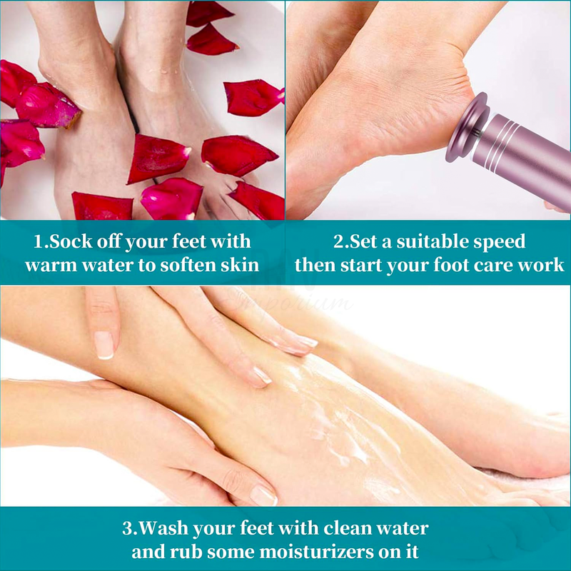 Hard Skin Remover