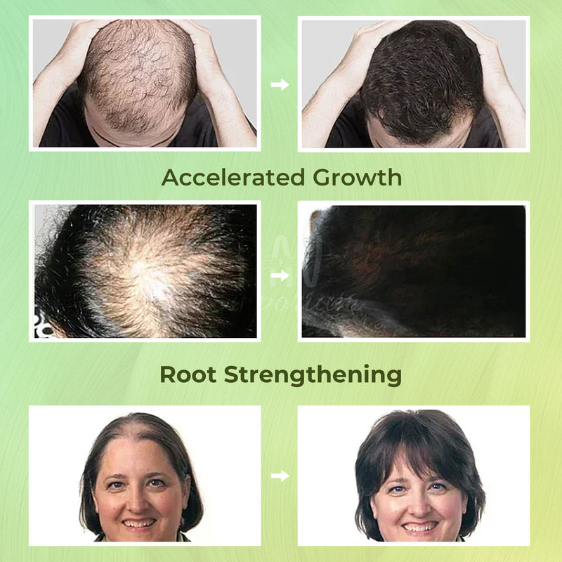 Woman massaging scalp with RapidRoot