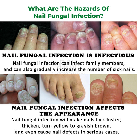 Moisturizing nail repair essence