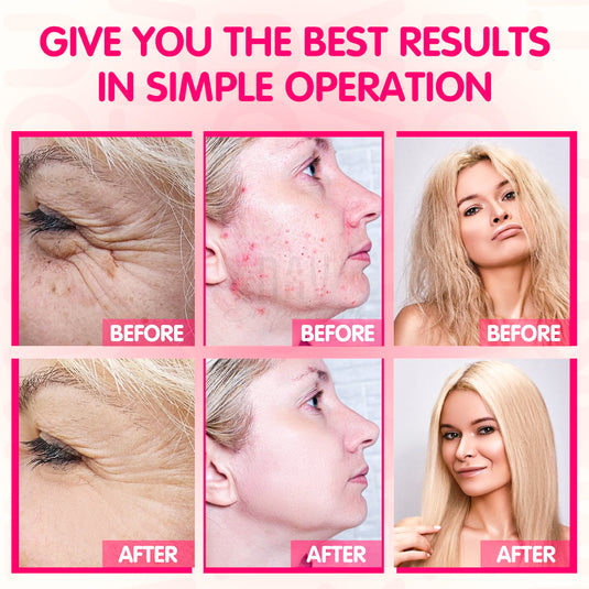 Wrinkle-reducing electrotherapy wand