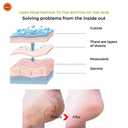 Callus Removal Foot Mask
