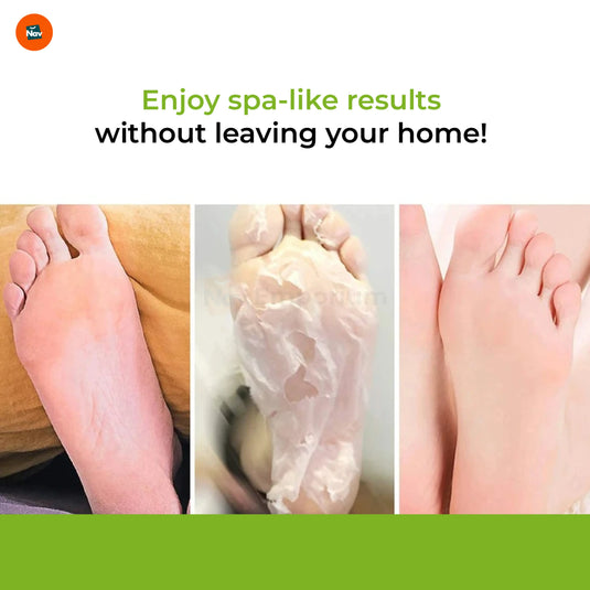 Smooth Feet After Peel