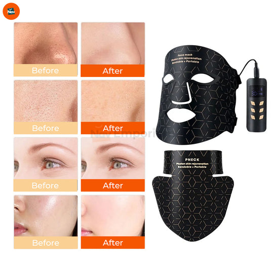 Home LED facial device