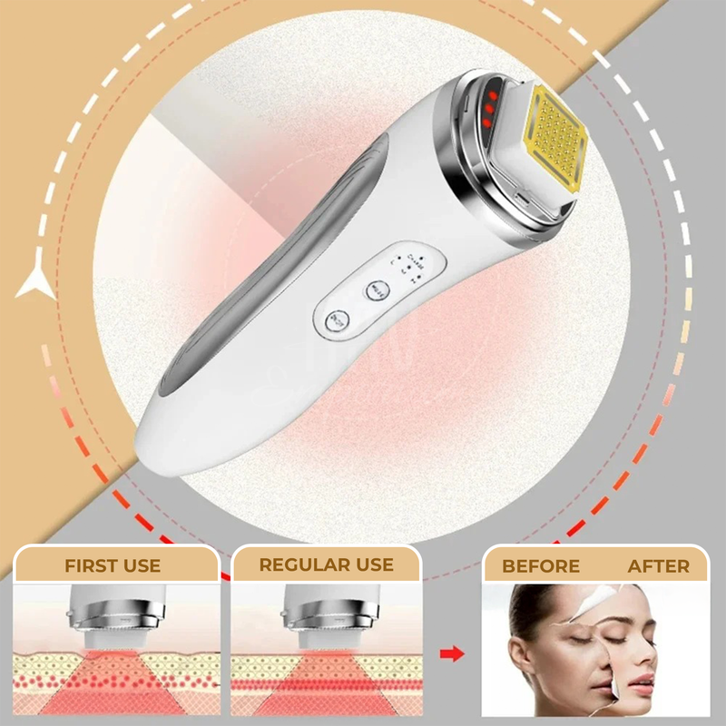 Radio Frequency Facial Massager
