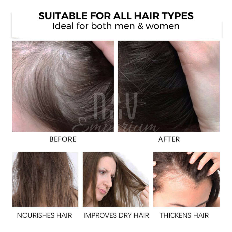 Natural remedy for hair loss