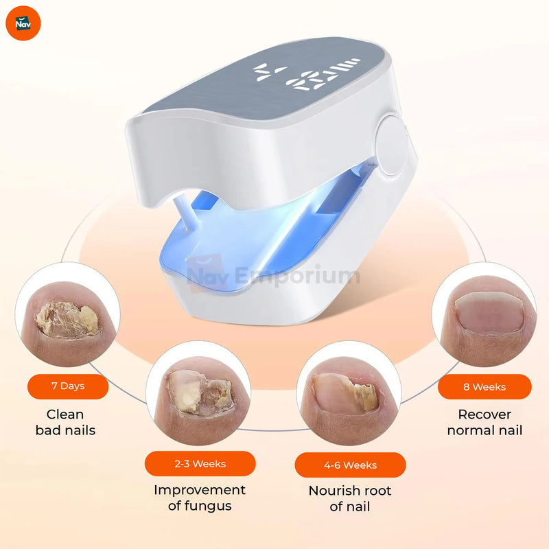  Non-invasive laser treatment for toenail fungus